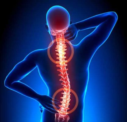 Thoát vị đĩa đệm và thoái hóa cột sống